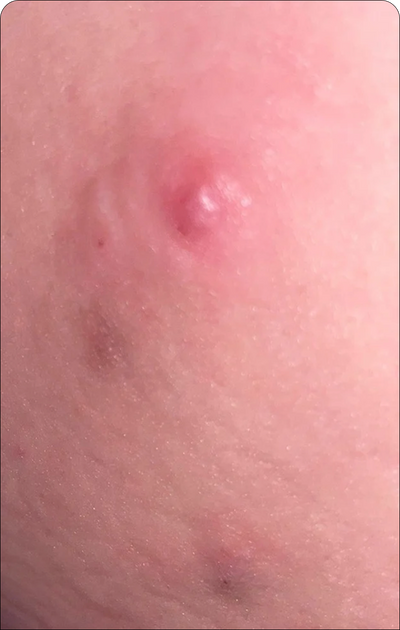 Day 1