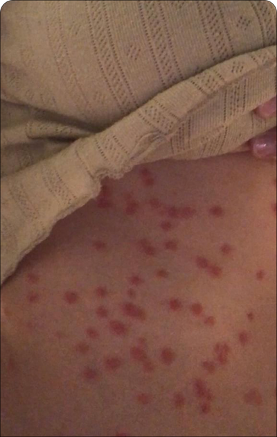 Day 1