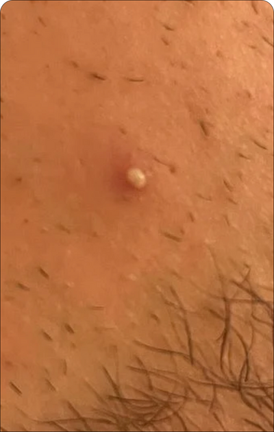 Day 1