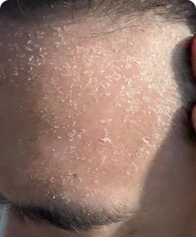 Day 1
