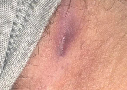 Day 4-6