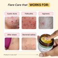 Folliculitis Flare Care Control