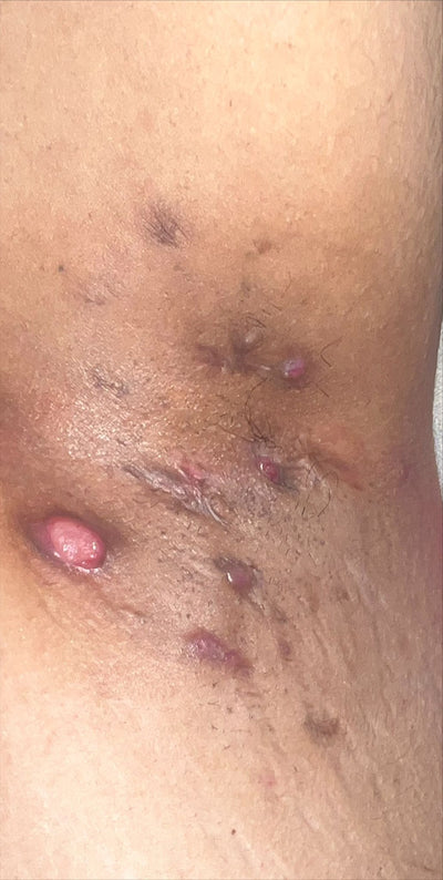 Day 01