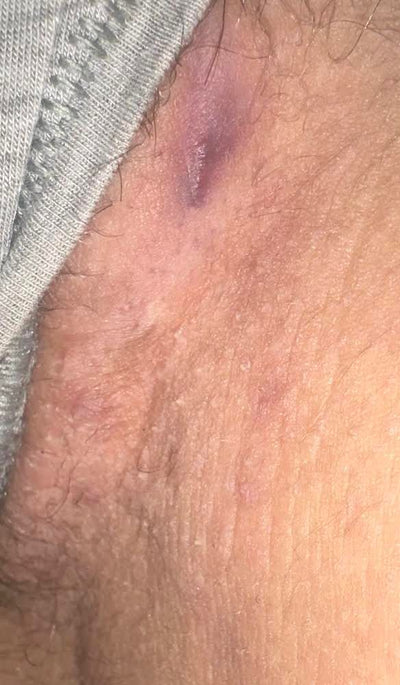 Week 2