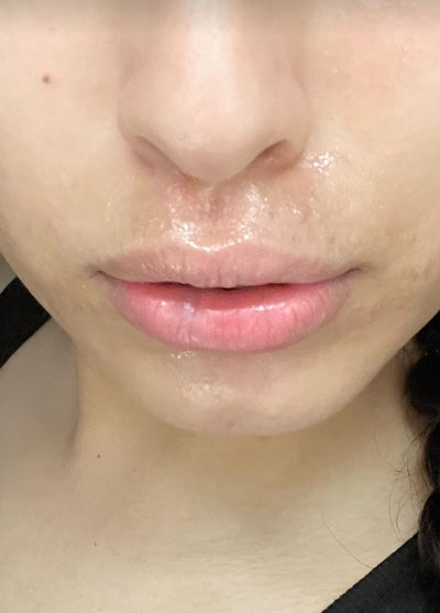 Day 25