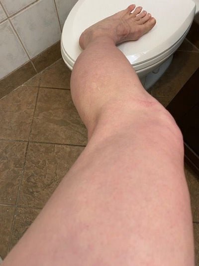 Day 10