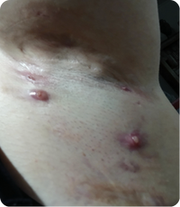 Before Image