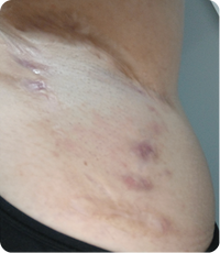After Image