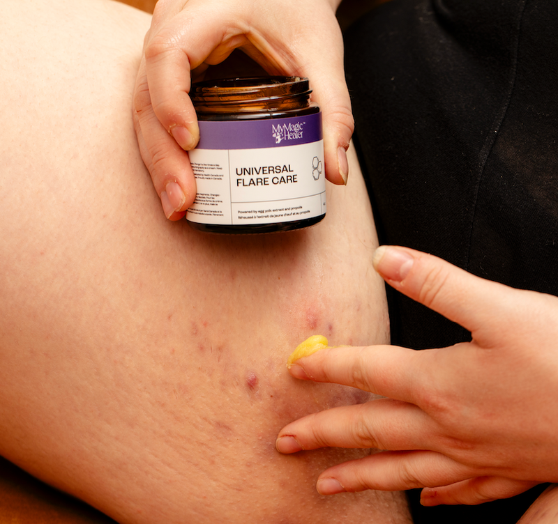 Your dry, irritated skin needs barrier support and protection