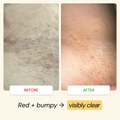 Post-Shave Comfort Routine
