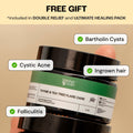 Best Flare Care Deal