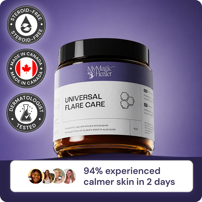 Universal Flare Care