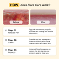 Best Flare Care Deal: Ultimate Healing Pack