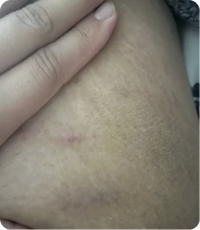 After Image