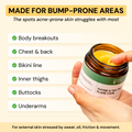 2-Step Acne Routine